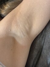 エンズ(O's)/憧れのキレイな脇へ！