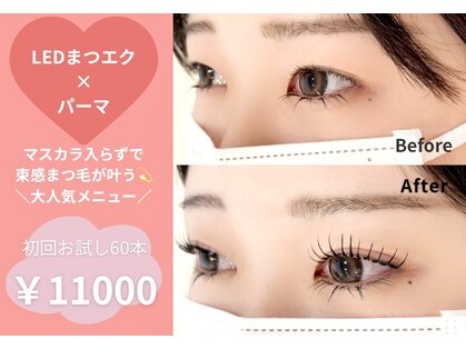 アルーマ アイ(allma.eye)の写真