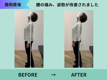 トミーリハ整体院(TOMMY REHA整体院)/上が向けなかったのに楽になった