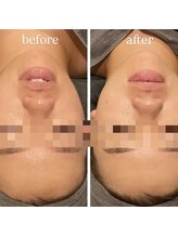 ラルミエール 緑店はなれ(la lumiere)/贅沢スペシャルコース