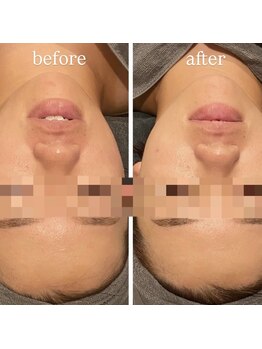 ラルミエール 緑店はなれ(la lumiere)/贅沢スペシャルコース