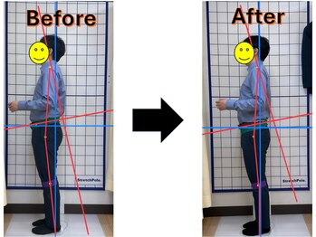 富沢駅前整骨院/姿勢分析で原因を探ります!