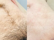 ハナワクシングプラス 高知(HanaWaxing+)/【メンズブラジリアン（VIO)】