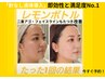 レモンボトル3cc◎二重アゴ【脂肪分解・小顔】即効性抜群60分¥25000→¥9000