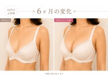 ラウリノサロン(Laurino salon)/何歳からでもバストアップOK！