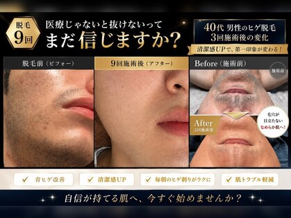 モデルズ(MODELS)の写真
