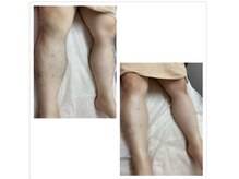 ラヴェスティ(Lovesty)/