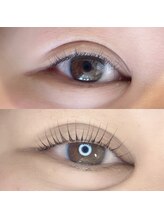 デイジー(DAY'S EYE)/ストレートデザイン