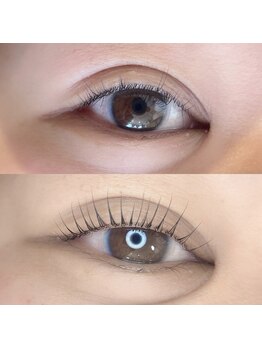 デイジー(DAY'S EYE)/ストレートデザイン