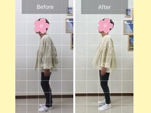 ナオル整体 春日部院(NAORU整体)/春日部/整体/猫背矯正/骨盤矯正