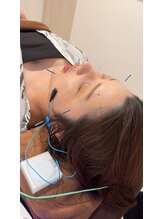 ハリファ鍼灸院 熊本院(HariFa鍼灸院)/美容鍼