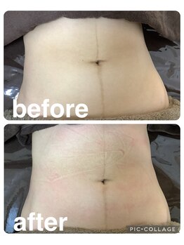 ギンザアール(GINZA R.)/くびれくびれボディに！