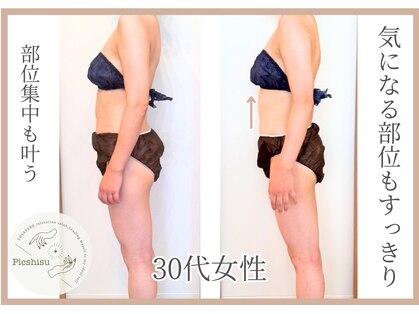 ヨサパーク ピクシス(YOSA PARK)の写真