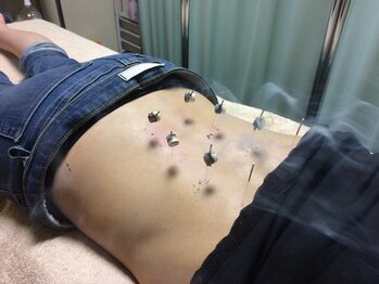 杏の樹鍼灸治療院の写真/【お身体の悩み・疲れを解消◎】経験豊富なスタッフがお身体の不調を改善！初めての方にもオススメです♪