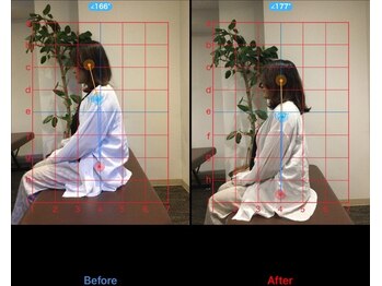 ケアハウス 戸塚(CARE HOUSE)/施術効果写真☆（before after）