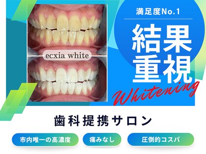 エクシアホワイトニング 岡崎店の写真