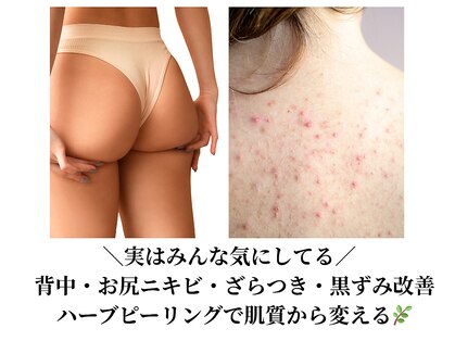 ビエストラ(Biestora)の写真