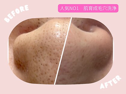 ディーロータス(D-lotus)の写真