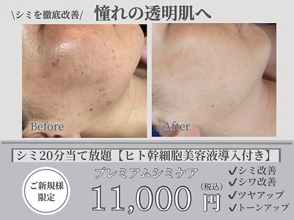 ルーチェ カリーノ(Luce Carino)の写真