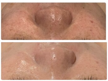 ボヌールエターナル(Bonheur eternel)/