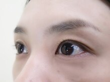 アビオ 戸田店(ABIO)/施術前★before