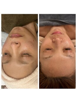 エリー(ERIE)/艶・ハリのあるお肌へ