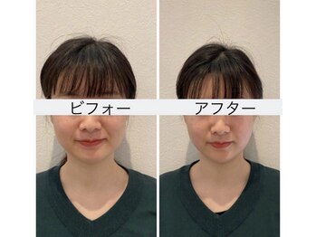 リモド(Rimodo509)/小顔矯正(ヘッドスパ