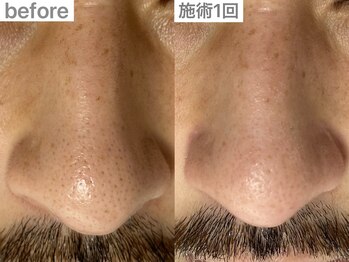 ユイット ルッカ(Huit Lucca)/ハイドラ×ララピール