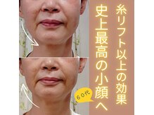 目元 口元のたるみ 眉間シワ改善専門サロン
