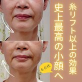 目元 口元のたるみ 眉間シワ改善専門サロン