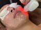 ビューティーサロン ヴェール(Veil)の写真/【男性の髭脱毛・女性の顔脱毛を初回お試し価格￥2,980！】パワーライト脱毛は美肌効果にも期待◎