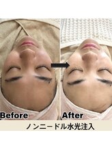 マヴィ 香里園店(MavY.)/今話題のレモンボトル