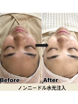 マヴィ 香里園店(MavY.)/今話題のレモンボトル