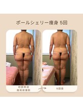 トータルサロン ヴィータ(VITA.)/ポールシェリー痩身/beforeafter