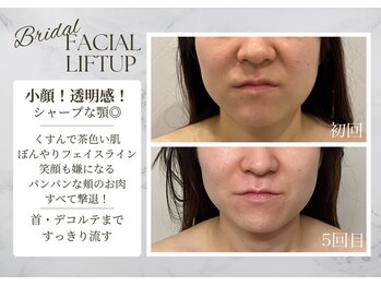 サロンドエリ ラクロワジエール(Salon d’ERI la Croisiere)の写真/毛穴が気になる方へ＊肌状態を見極め、お悩みに合わせた究極のフェイシャルケアで自分史上最高の美肌へ♪
