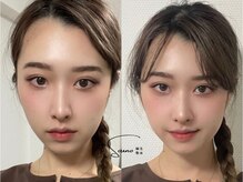 ソウノ 御茶ノ水(Souno)/お客様ビフォー・アフター