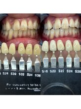 トウキョウスワーズ 池袋店(TOKYO SWRS)/#ホワイトニング #池袋 #渋谷