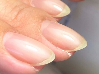 エル トウキョウ キャンディ(L tokyo CANDY)の写真/ジェルをしないで育成可能◎割れ爪、2枚爪、深爪などのお悩みの方はご相談ください♪