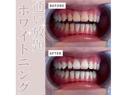 エクシアホワイトニング 今池店の写真