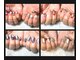 ニコネイル(NICO NAIL)の写真