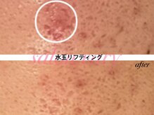 サロンヴェアリー 広尾(salon vary)/水玉リフティング　