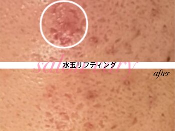 サロンヴェアリー 広尾(salon vary)/水玉リフティング　