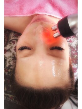 シャンディール(shandeel)/小顔ラジオ波