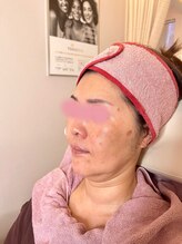 リフティングラボ(LIFTING LAB)/水玉リフティング＆ビーナス