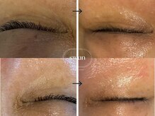 スワン 大阪南堀江(swan)/目元の小じわが気になる方