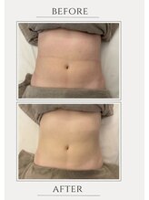 ブリッサム 恵比寿店(Blissum)/腸の位置でお腹は変わる