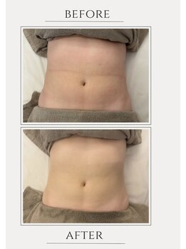 ブリッサム 恵比寿店(Blissum)/腸の位置でお腹は変わる