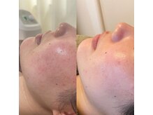 アトリエリン 小牧本店(Atelier Rin)/1人1人のお悩み解決サロン