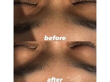 ウネ 吉祥寺(une)/眉間もすっきり