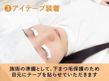 イリマ 岡山駅前店(Irima)/3.アイテープ装着
